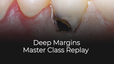 Deep Margins MasterClass