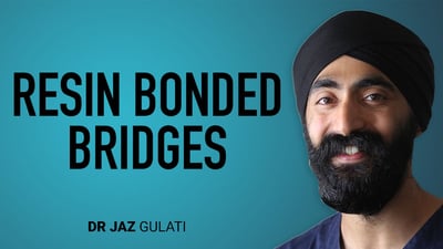 Resin Bonded Bridges - Part 2