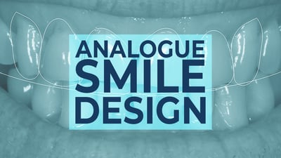 Analogue Smile Design