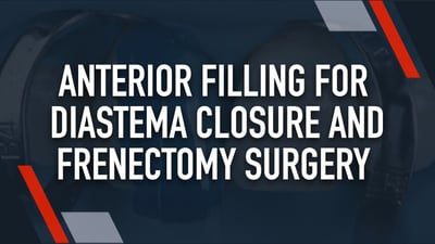 Anterior Filling for Diastema Closure and Frenectomy Surgery