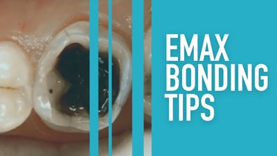 Emax Bonding Tips
