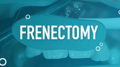 Frenectomy