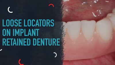 Loose Locators on Implant Retained Denture