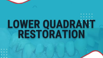 Lower Quadrant Restoration - Part 1
