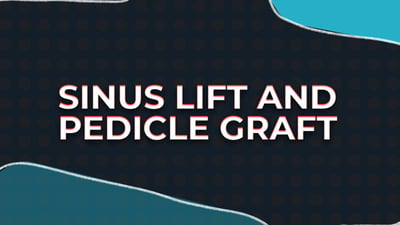 Sinus Lift and Pedicle Graft