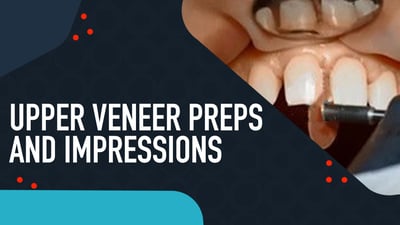 Upper Veneer Preps and Impressions