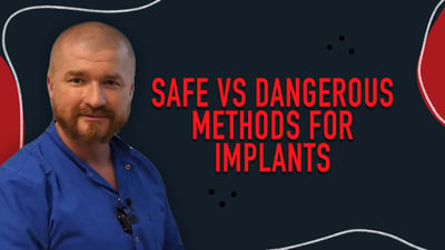 Safe vs Dangerous Methods for Implants